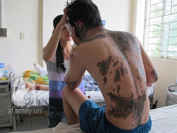 Bi kịch của người đàn bà lãnh trọn ca axít bởi tính lẳng lơ