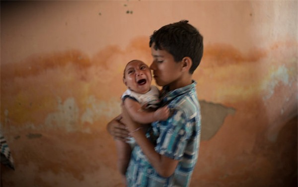 Zika, virus Zika, teo não, tật đầu nhỏ