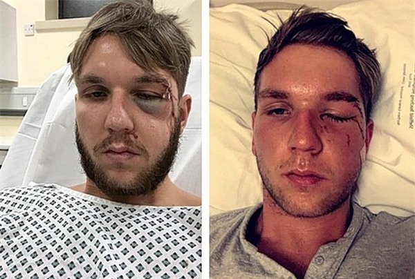 Chấn thương kinh hoàng khiến thủ môn kết thúc sự nghiệp sau... 15 phút ra mắt CLB mới - Ảnh 1.