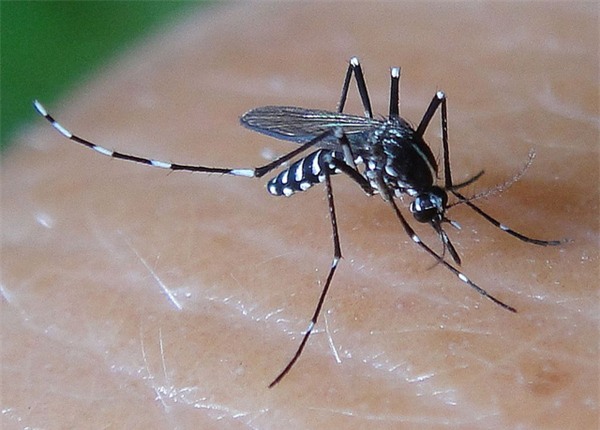 Thai phụ nhiễm Virus Zika ở Việt Nam: Thai nhi có mắc hội chứng đầu nhỏ? - Ảnh 1.