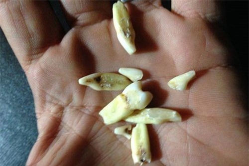 tu dap gay rang, nhan boi thuong tien ty hinh anh 2