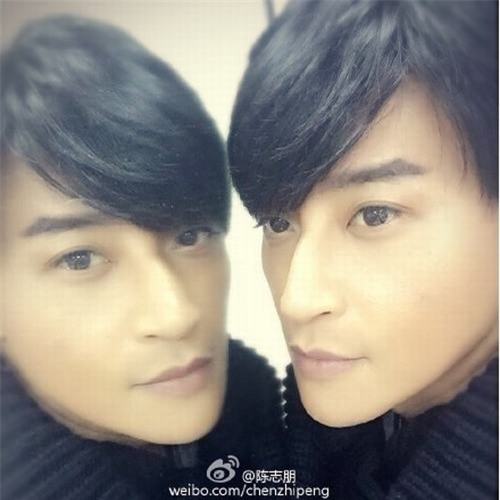 Sao Hoàn Châu cách cách bị bỏng nặng 3