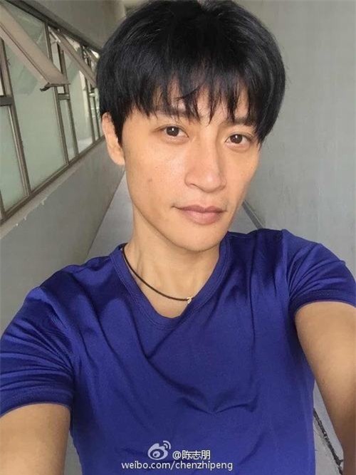 Sao Hoàn Châu cách cách bị bỏng nặng 2