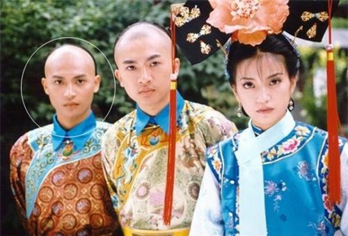 Sao Hoàn Châu cách cách bị bỏng nặng 4