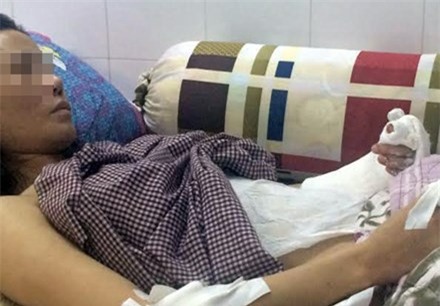 Người phụ nữ với vết chém gần lìa bàn tay. Ảnh VNE