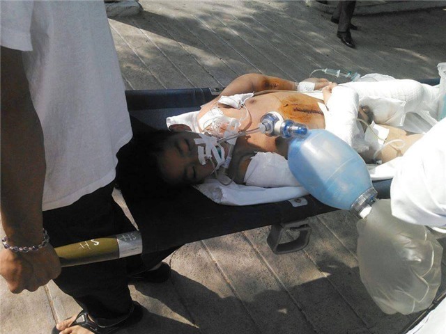 Bé Sa lúc mới nhập viện trên người chằng chịt các vết thương