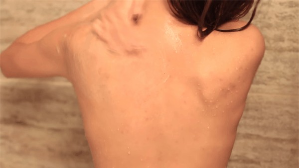 trị mụn ở lưng