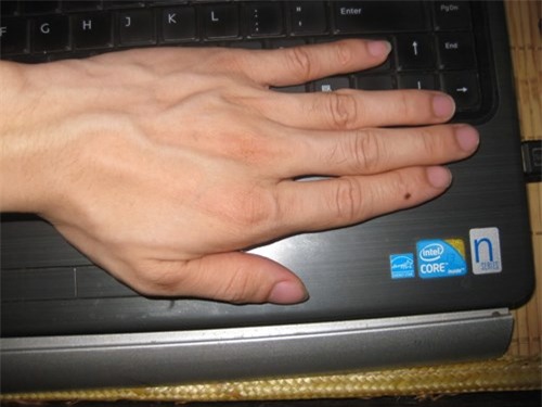 Bestie-not-ruoi-ngon-tay