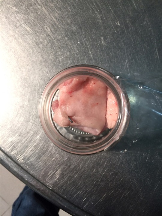 Hoảng hồn phát hiện kim tiêm trong thịt heo - 1