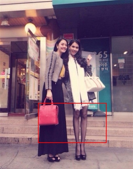 Lại một lần nữa cô bị soi đôi chân dài không đúng tỉ lệ