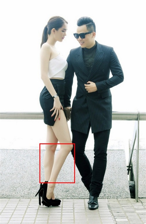 Một chân của “Nữ hoàng nội y” đã bị teo?