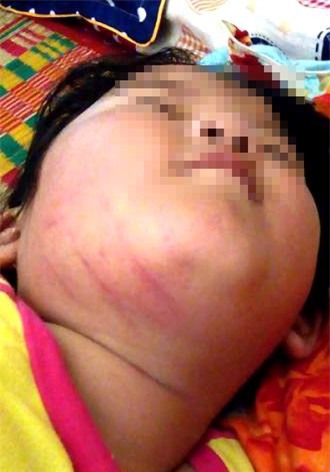 Phu huynh to co giao dung thuoc go danh bam mat tre hinh anh 1