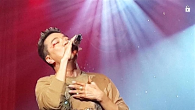 Diễn quá sung, Đàm Vĩnh Hưng gặp tai nạn chảy máu mắt - Ảnh 2.