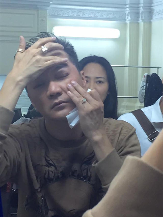 Diễn quá sung, Đàm Vĩnh Hưng gặp tai nạn chảy máu mắt - Ảnh 4.