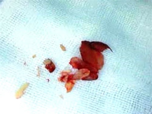 cuu song be gai 3 tuoi nguy kich vi hoc hat o mai - 1