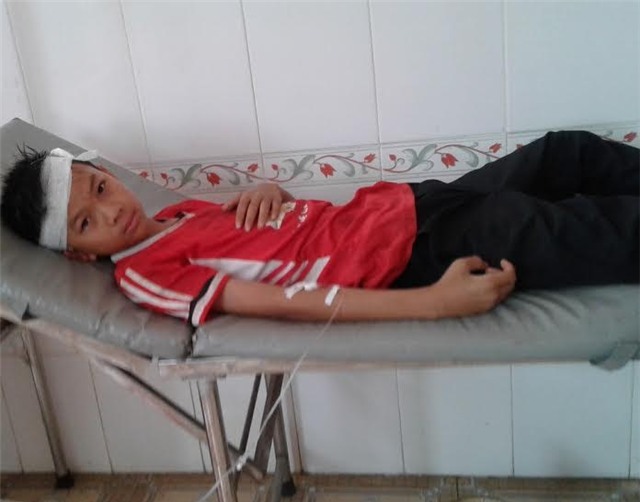 quạt trần, rơi, chấn thương, học sinh