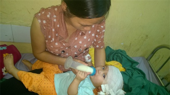 Cháu bé 11 tháng tuổi hồi phục tốt sau phẫu thuật (ảnh: bác sĩ cung cấp)