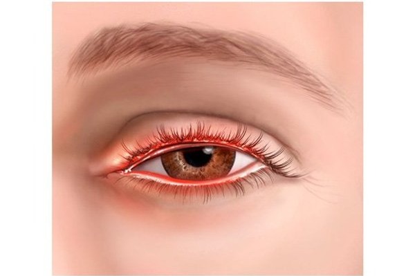 can benh ban de mac khi lam viec voi may tinh nhieu gio hinh anh 2