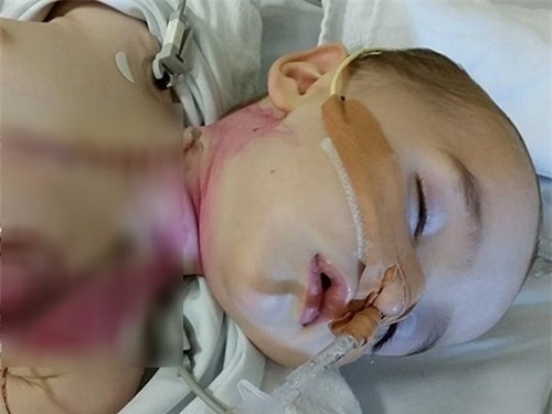 suyt mat con chi vi thay tre ho lien tuc ma khong kham - 2