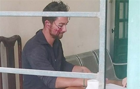 Micheal Hofmeister, đối tượng đã quậy phá, hủy hoại tài sản ở phường Bồ Đề..