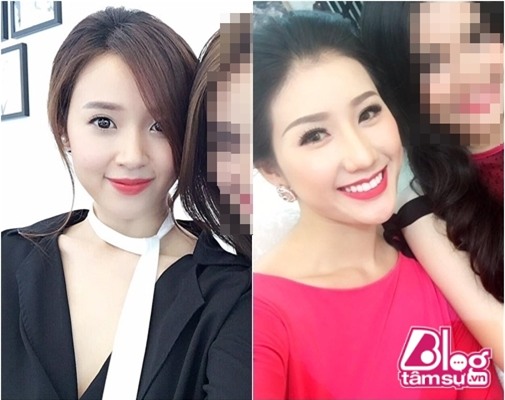 so-sanh-nhan-sac-midu-va-tinh-moi-phan-thanh-blogtamsuvn1