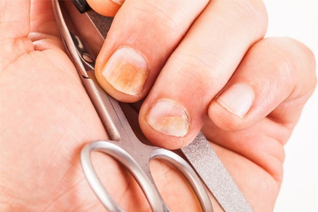 Nhung nguyen nhan it ngo can di kham da lieu hinh anh 1