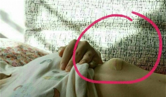 Đi phẫu thuật thẩm mỹ bị bác sĩ để quên băng gạc trong bụng 6