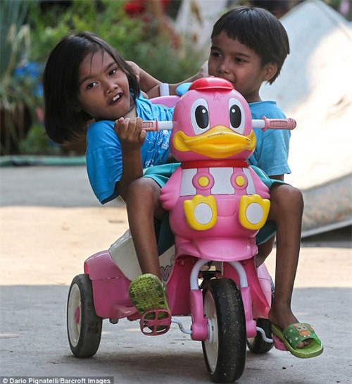 cuoc song vui ve cua cap sinh doi dinh lien than duoi - 3