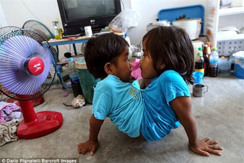 cuoc song vui ve cua cap sinh doi dinh lien than duoi - 4