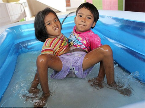 cuoc song vui ve cua cap sinh doi dinh lien than duoi - 5