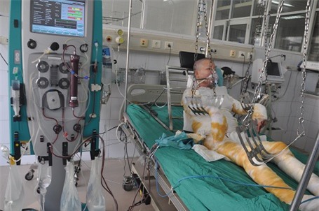 Tình trạng của chị càng nặng hơn khi chị đang phải lọc máu và thở máy.