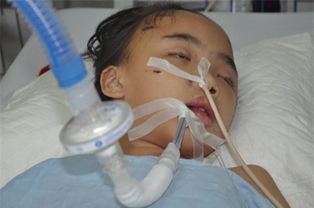 Em bị tổn thương não cùng tình trạng nhiễm trùng nặng.