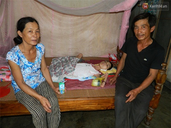 Cô gái mắc bệnh lạ suốt 26 năm nằm một chỗ, lở loét khắp người - Ảnh 2.