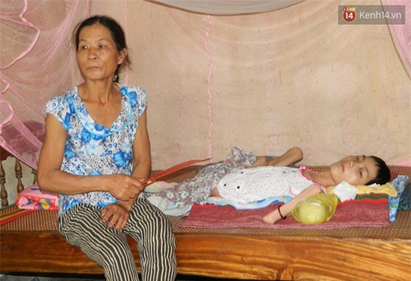 Cô gái mắc bệnh lạ suốt 26 năm nằm một chỗ, lở loét khắp người - Ảnh 3.