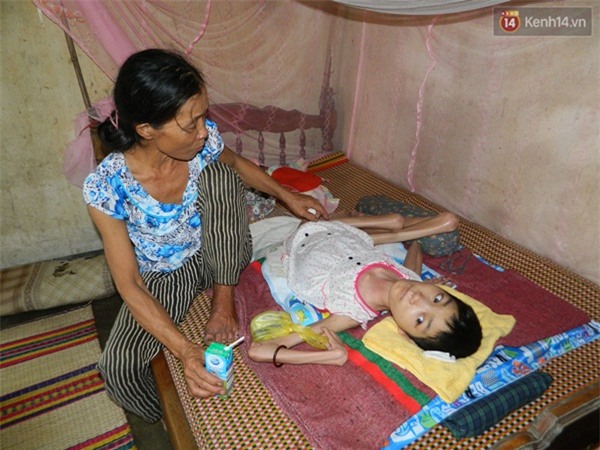 Cô gái mắc bệnh lạ suốt 26 năm nằm một chỗ, lở loét khắp người - Ảnh 4.