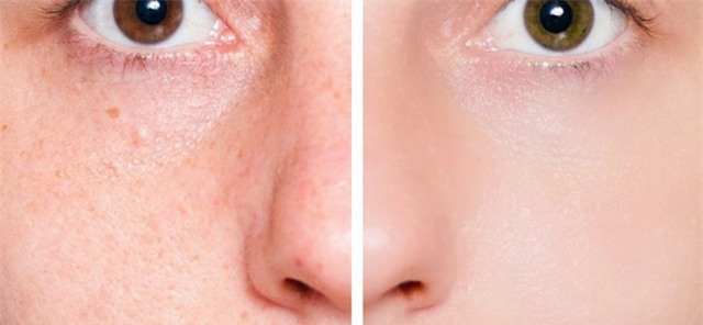 Xông mặt ngay tại nhà giúp da sáng mịn sạch mụn suốt mùa hè - Ảnh 1.