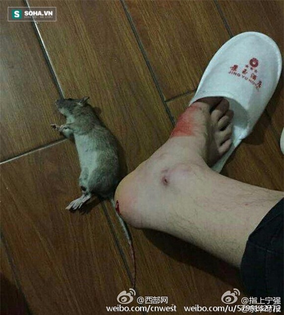  Hình ảnh được nạn nhân bị chuột cắn đăng tải lên mạng để bày tỏ sự bức xúc đối với dịch vụ của khách sạn Cảnh Ngọc. 