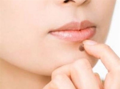 not-ruoi-blogtamsu 2