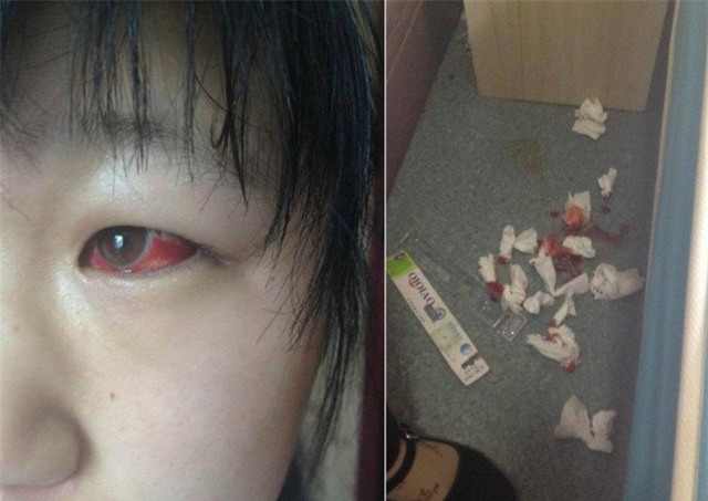 nhiem doc tu ban hoc trung quoc, mat hoc sinh do nhu ma ca rong hinh anh 1