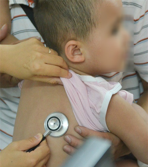 nhung benh mua he phu huynh nen de phong cho con - 2