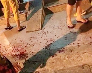 Camera ghi hinh hung thu bit mat dam chu tiem vang hinh anh 2