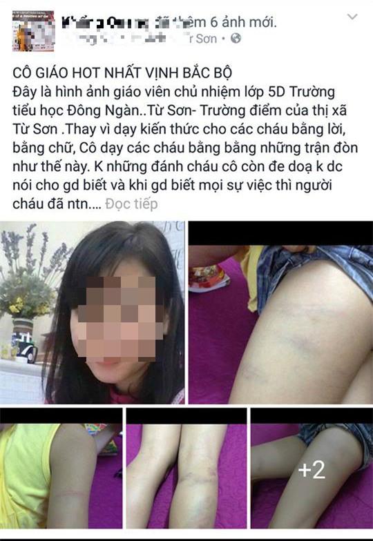 Giao vien danh hoc sinh tim nguoi vi khong lam bai hinh anh 1