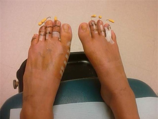 Bi kịch những đôi chân túa máu vì giày cao gót khiến chị em phát sợ - Ảnh 2.