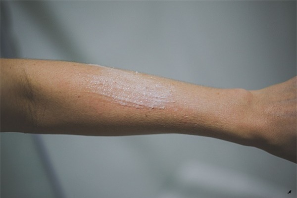 Những phương pháp tẩy tế bào chết cho từng vùng khác nhau trên cơ thể