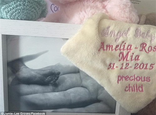 xot xa me bau mat con chi vi can benh pho bien o phu nu - 3