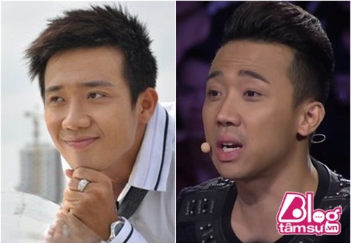 tran-thanh-phau-thuat-tham-my-blogtamsuvn5