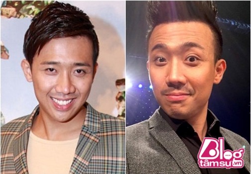 tran-thanh-phau-thuat-tham-my-blogtamsuvn3