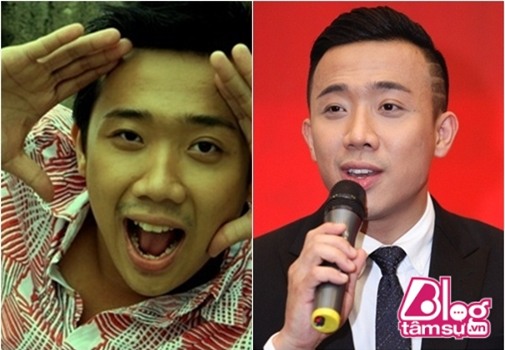 tran-thanh-phau-thuat-tham-my-blogtamsuvn4