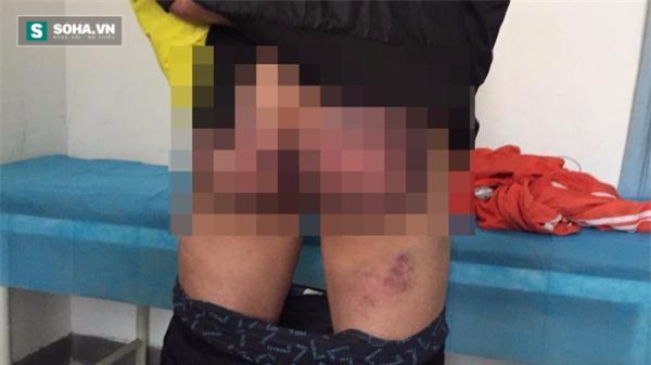 Quay clip cảnh sát hành sự thô bạo, hai sinh viên bị đánh dã man - Ảnh 2.