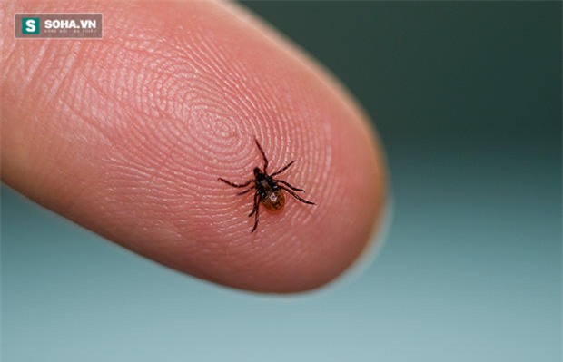 5 loại bệnh dễ bị chẩn đoán nhầm - Ảnh 1.